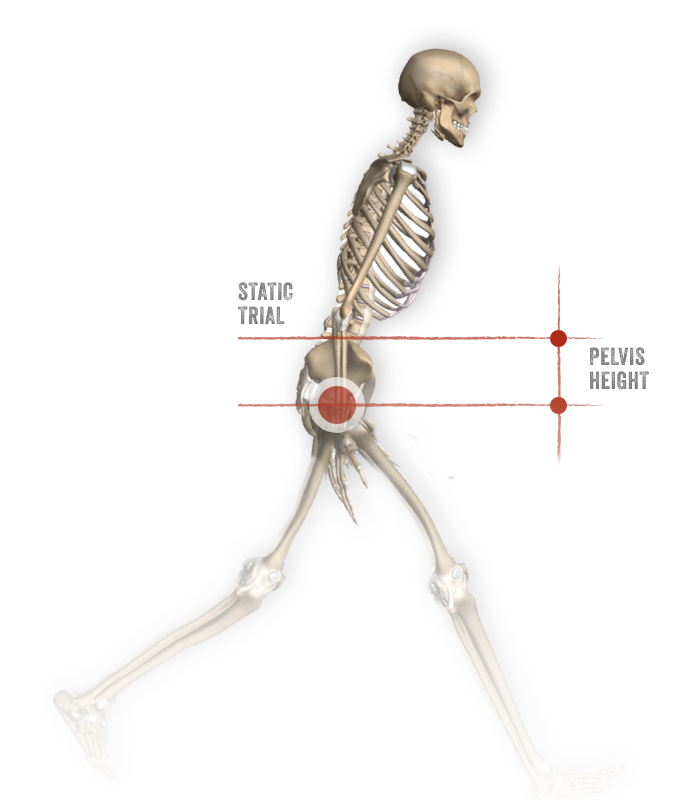 Pelvis Displacement